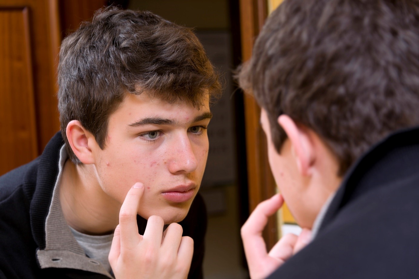 Jongen met acne op zijn gezicht