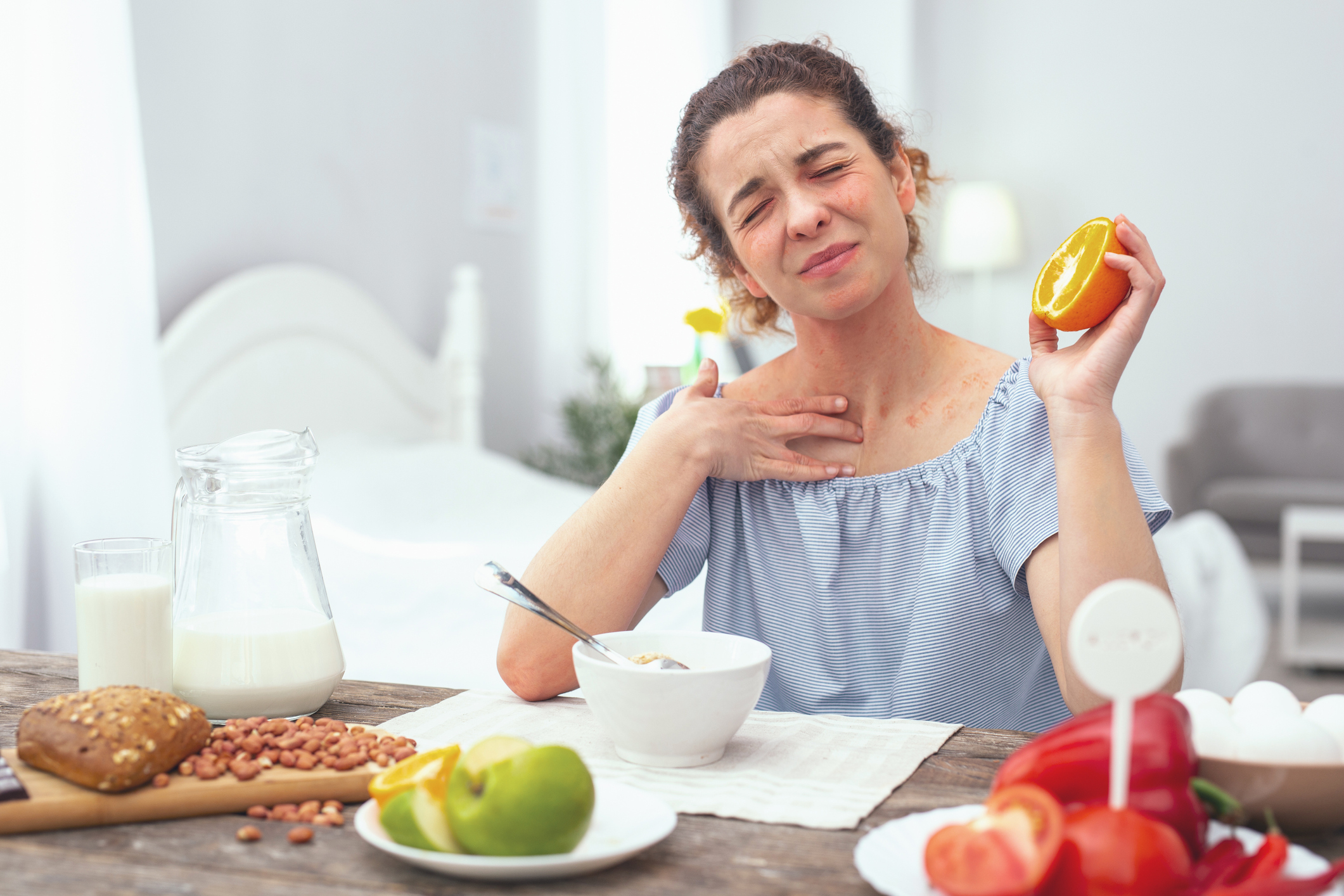 Bij atopische dermatitis zijn citrusvruchten verboden