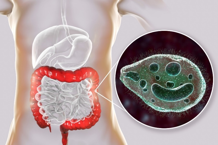 Balantidium coli - een parasiet die de dikke darm van het menselijke spijsverteringskanaal infecteert