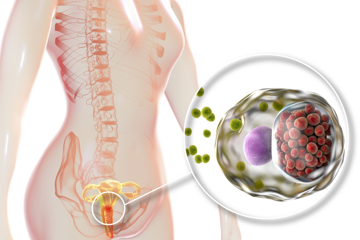 Infectie is de baarmoederhals binnengedrongen - anatomische weergave van het vrouwelijke voortplantingssysteem