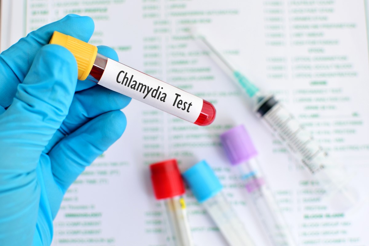 Chlamydia-test - bloed in reageerbuis, gehandschoende hand die reageerbuis vasthoudt, reageerbuis op achtergrond, naald