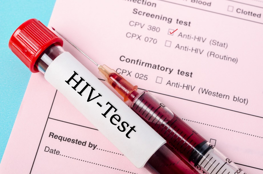 Diagnostische test voor de aanwezigheid van anti-HIV-antistoffen in het bloedmonster van een patiënt