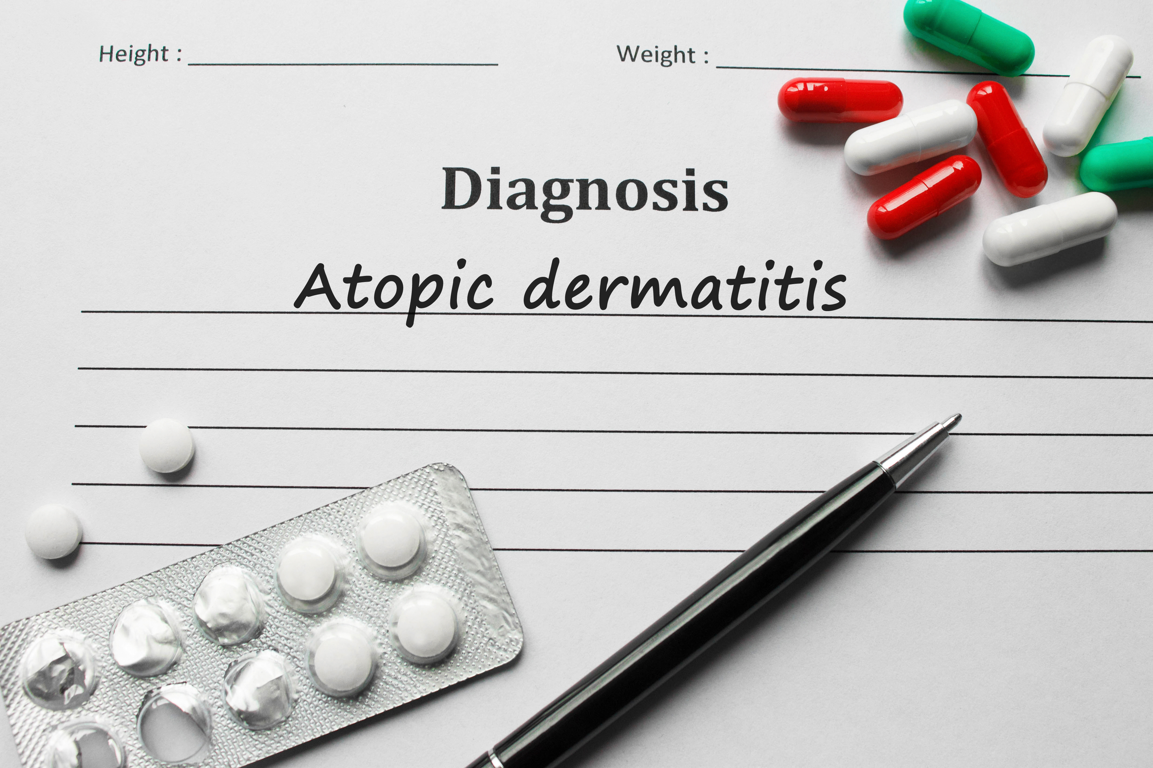 Diagnose van atopische dermatitis