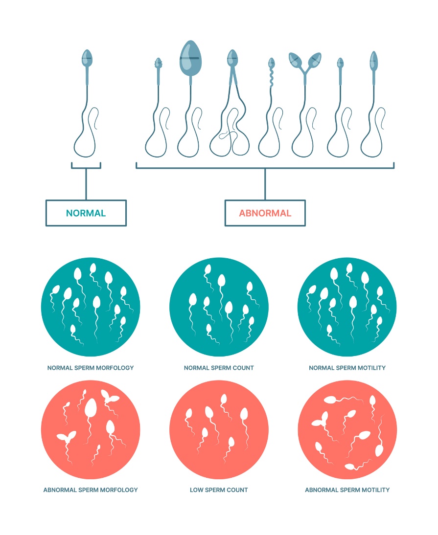 Fysiologische en abnormale toestand van spermatozoa. Spermamorfologie, aantal en beweeglijkheid