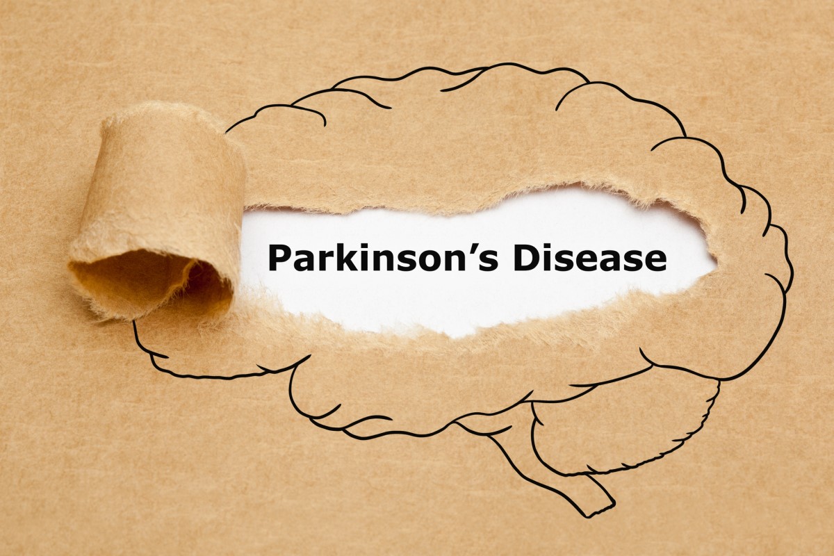 Morbus parkinson = ziekte van Parkinson - animatie van een brein met Parkinson in het midden