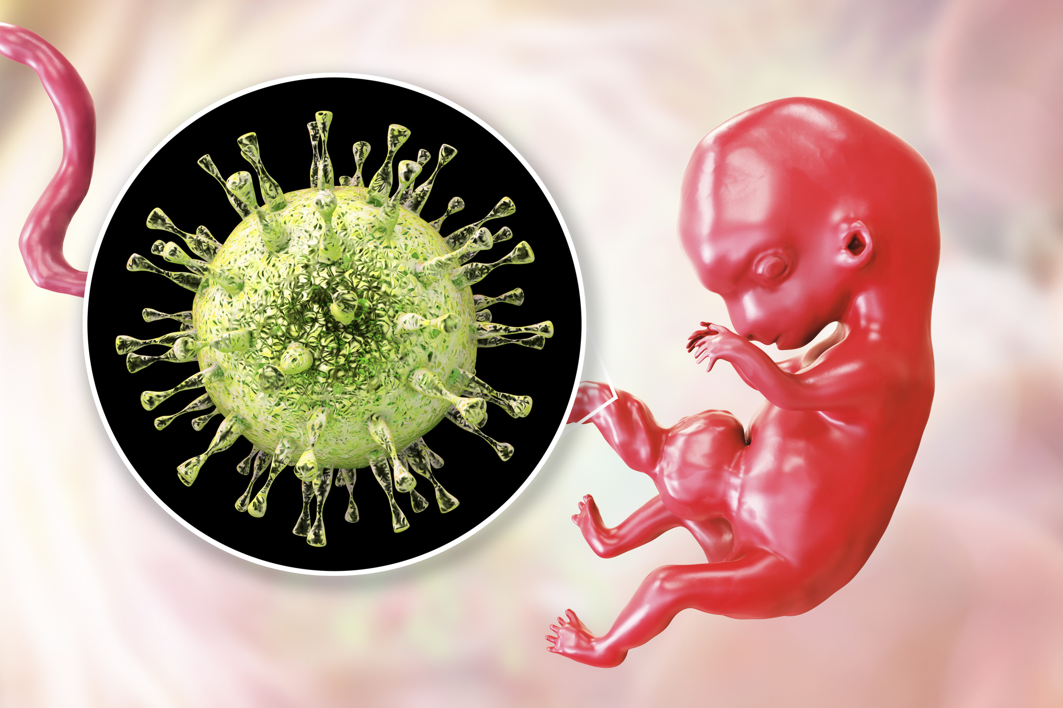 Transplacentaire overdracht van cytomegalovirus