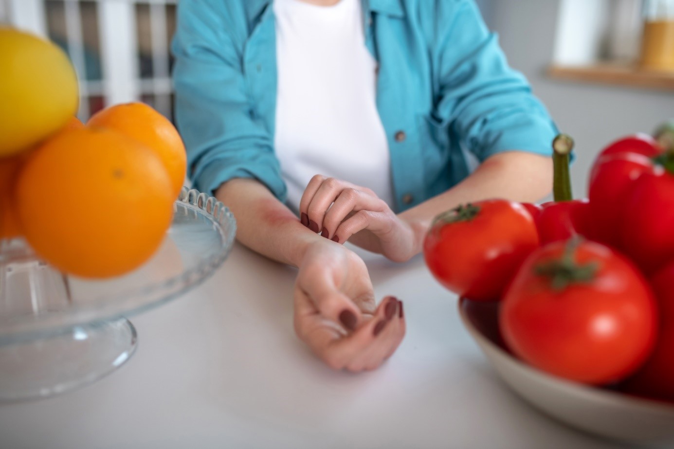 Vrouw heeft netelroos na het eten van fruit of groenten? Ze krabt aan haar onderarm