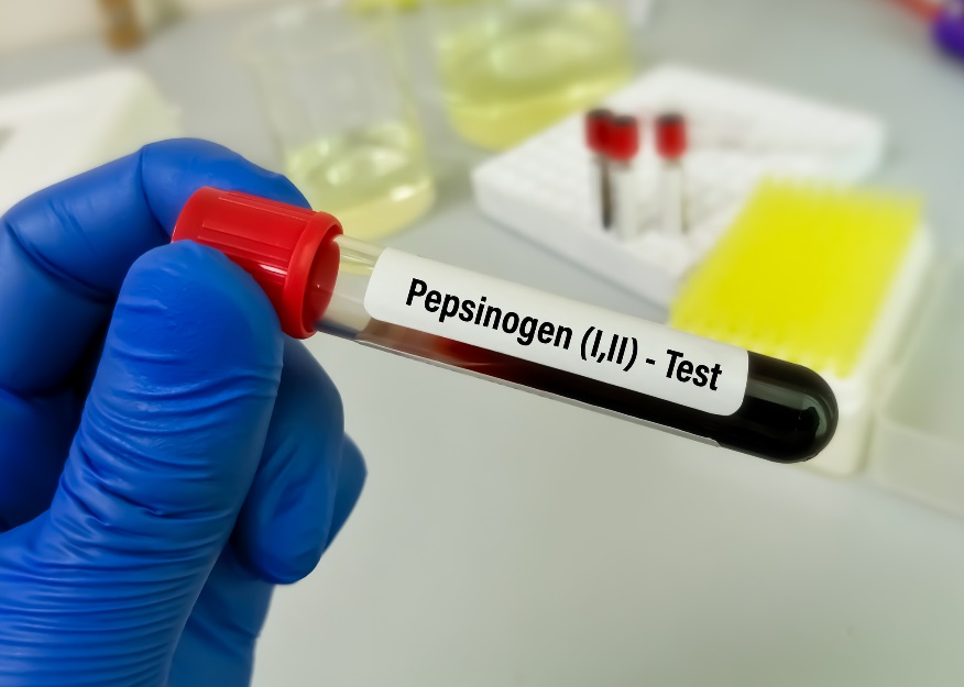 Bloedmonster voor laboratoriumtests op pepsinogeenspiegel en maagdarmziekte