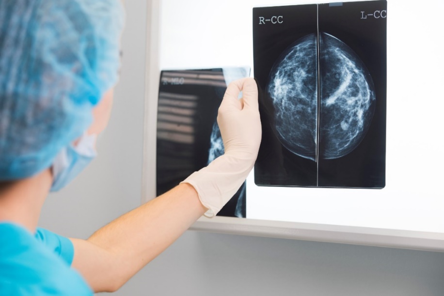 Mammogram van de borst