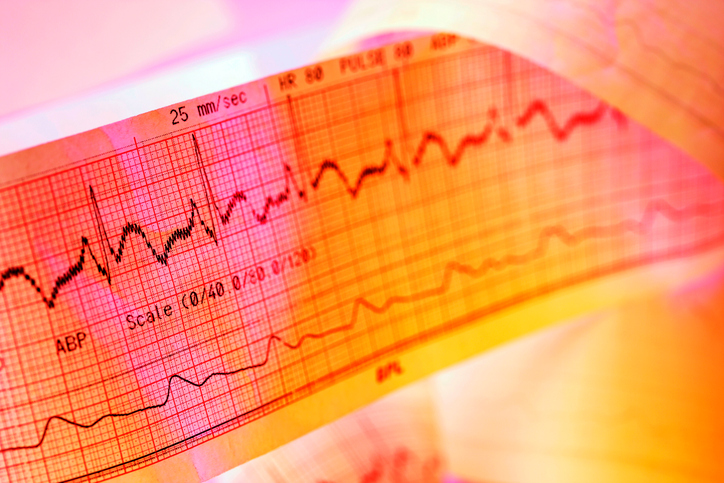 ECG-opname