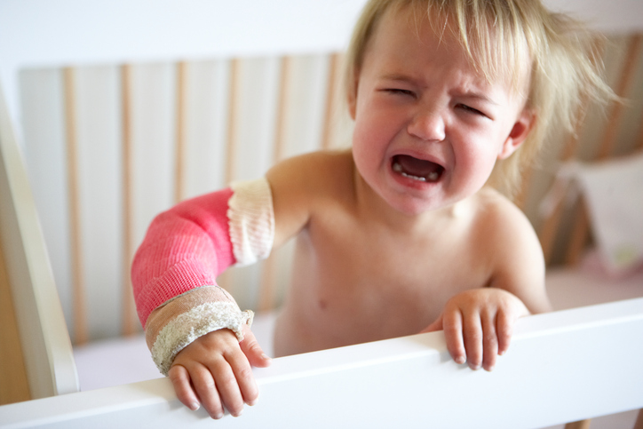 Het kind huilt, heeft pijn in het bovenste lidmaat, voor een breuk van de onderarm, het bovenste lidmaat is gefixeerd in een gips, in een spalk