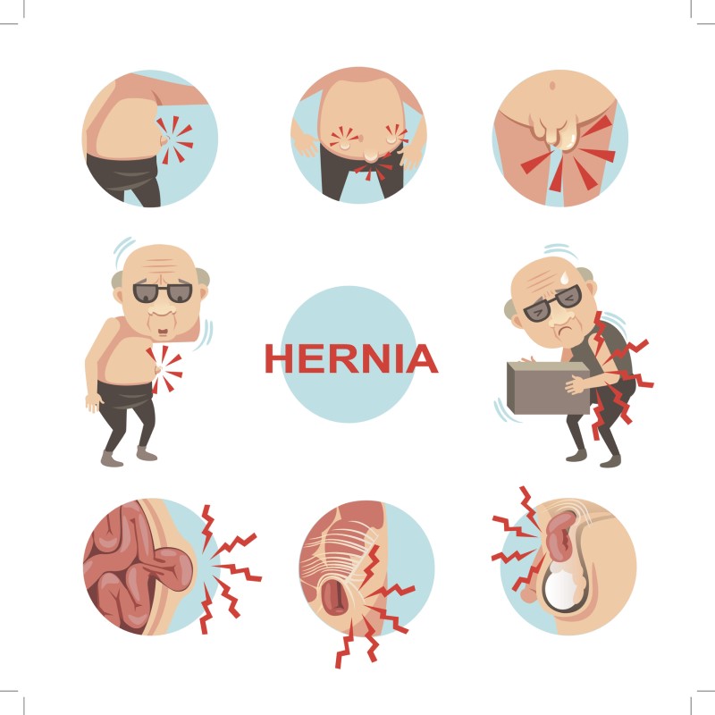 Hernia - symptoommodel