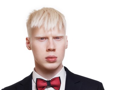 jonge albino man, wit haar, draagt een jas