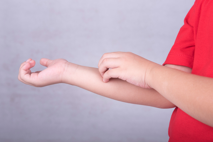 Baby krabt aan zijn onderarm, krabt aan zijn onderarm