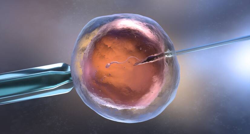 In-vitrofertilisatie IVF. bron: Getty Images