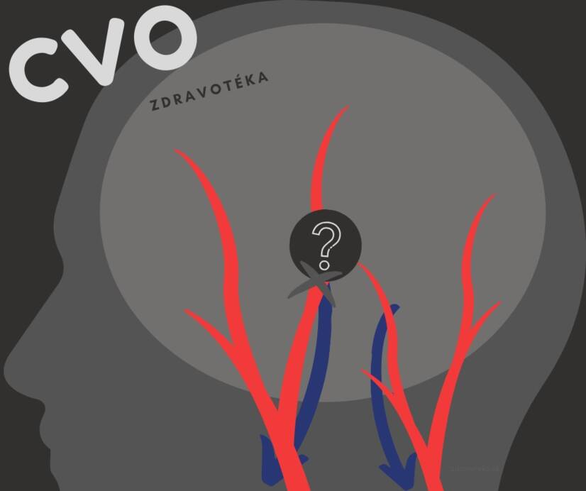 Cerebrovasculaire aandoening: verzwakte, vernauwde of verwijde cerebrale bloedvaten? Ken de oorzaken en symptomen