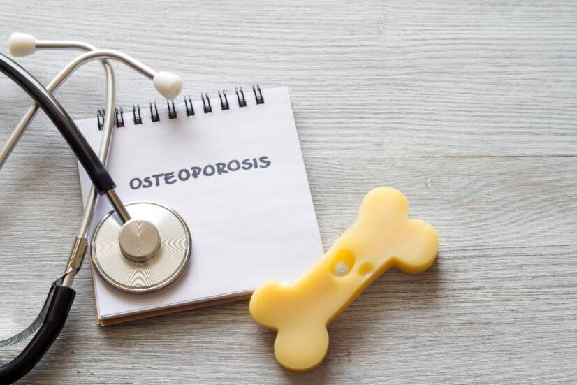 OSTEOPOROSIS: Wanneer botten verzwakken en behandeling moeilijk is. Wat zijn de oorzaken, symptomen en gevolgen + tips voor preventie?