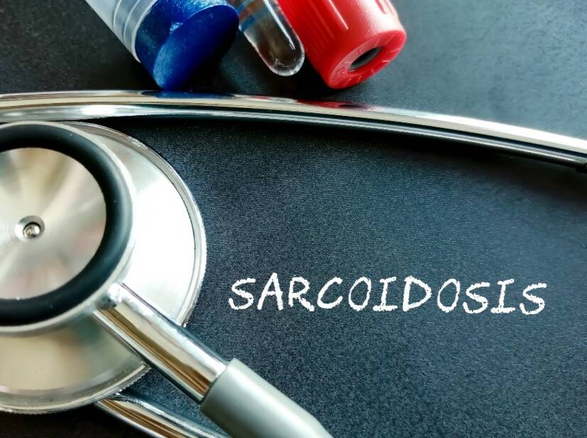 Sarcoïdose: Wat is sarcoïdose en wat zijn de oorzaken/symptomen? Pulmonale en extrapulmonale vormen