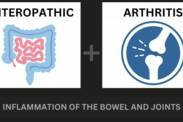 Enteropathische artritis en inflammatoire darmziekte: wat is hun verband + Symptomen