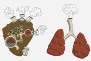 Pulmonale hypertensie: wat is het en waarom ontstaat het? + Symptomen en behandeling